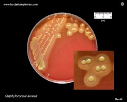 golden staph (s.aureus) on Schaedler (Schoedler) agar